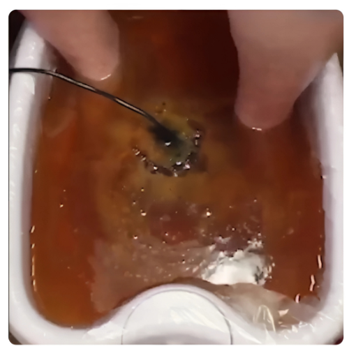 Noroa "CalmDetox" Fußbad & Spa